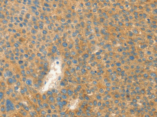 AANAT Polyclonal Antibody Store at -20°C