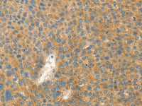 AANAT Polyclonal Antibody Store at -20°C