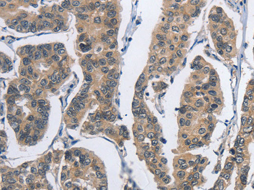 DSG2 Polyclonal Antibody Store at -20°C