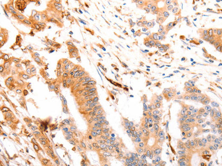 ABCA4 Polyclonal Antibody