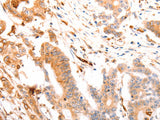 ABCA4 Polyclonal Antibody