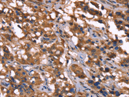 GREB1 Polyclonal Antibody Store at -20°C
