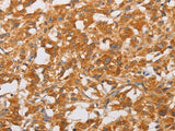 OLR1 Polyclonal Antibody