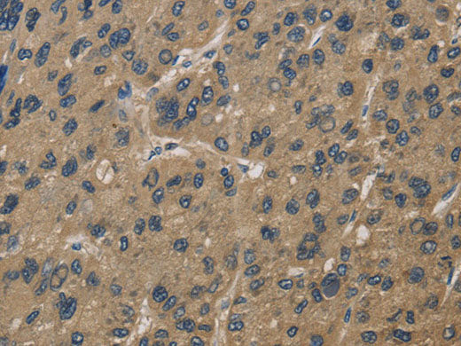 CORO1C Polyclonal Antibody Store at -20°C