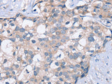 KCNQ5 Polyclonal Antibody Store at -20°C