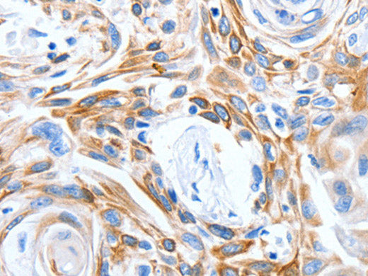 LRIG3 Polyclonal Antibody
