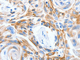 LRIG3 Polyclonal Antibody