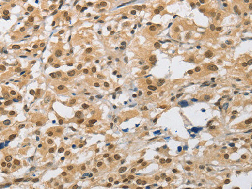 AMZ2 Polyclonal Antibody Store at -20°C