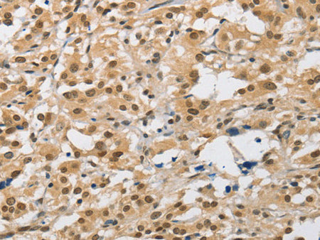 AMZ2 Polyclonal Antibody Store at -20°C