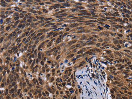 FASTKD5 Polyclonal Antibody Store at -20°C