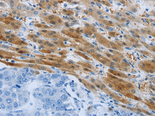 PSMD11 Polyclonal Antibody Store at -20°C