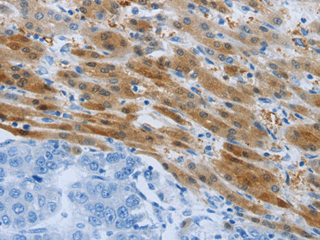 PSMD11 Polyclonal Antibody Store at -20°C