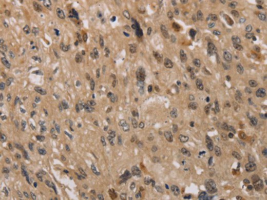 KDM4A Polyclonal Antibody Store at -20°C