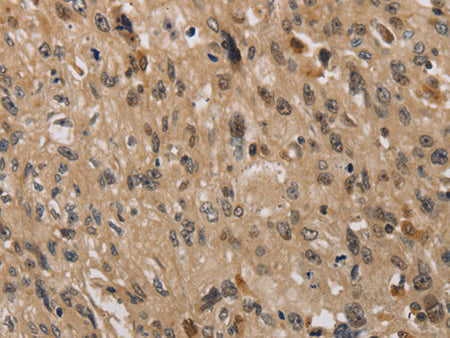 KDM4A Polyclonal Antibody Store at -20°C