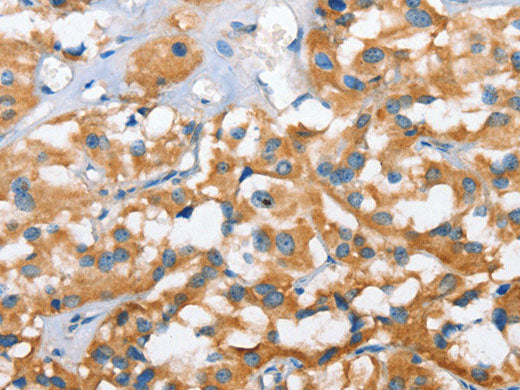 CXCL14 Polyclonal Antibody Store at -20°C