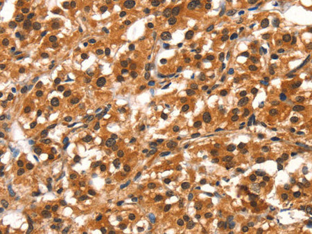 DDX4 Polyclonal Antibody Store at -20°C