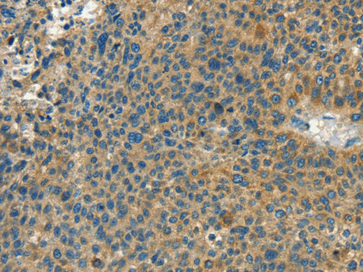 CALCA Polyclonal Antibody Store at -20°C