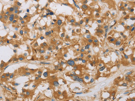 RAD54L2 Polyclonal Antibody Store at -20°C