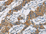 PIP4K2A Polyclonal Antibody Store at -20°C