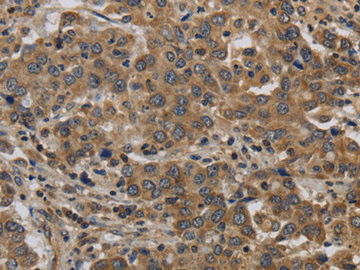 KIF4A Polyclonal Antibody Store at -20°C