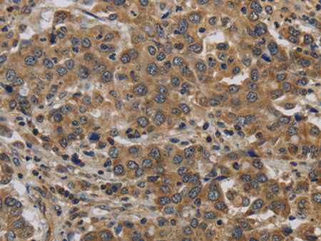 KIF4A Polyclonal Antibody Store at -20°C
