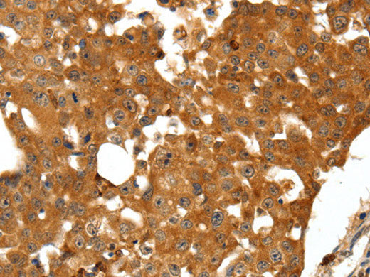SSTR1 Polyclonal Antibody Store at -20°C