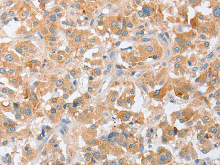 SIGLEC9 Polyclonal Antibody Store at -20°C
