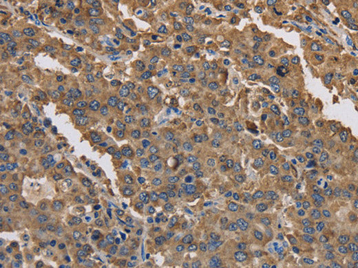 KCNG1 Polyclonal Antibody Store at -20°C