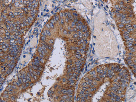 NDUFA1 Polyclonal Antibody