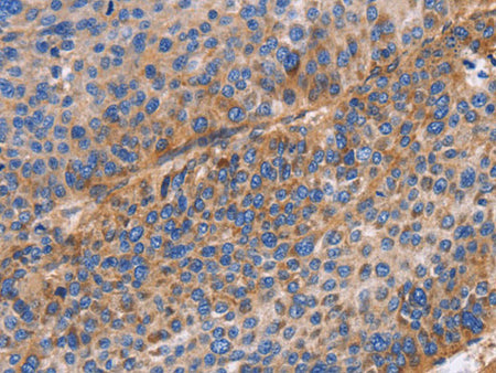 ITGB1 Polyclonal Antibody Store at -20°C