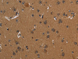 CD242 Polyclonal Antibody Store at -20°C