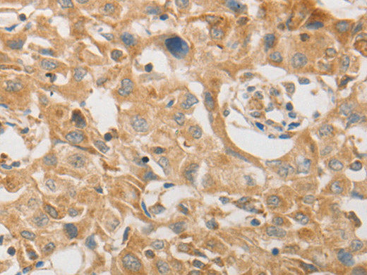 PLPP1 Polyclonal Antibody Store at -20°C