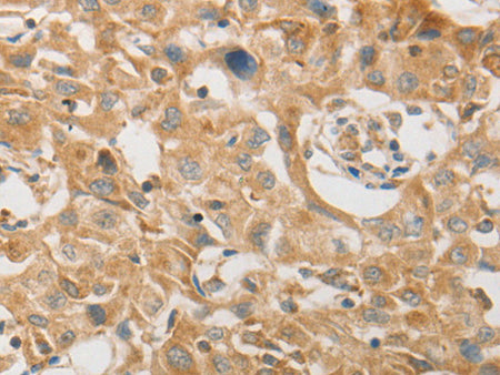 PLPP1 Polyclonal Antibody Store at -20°C