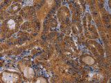 MAGEB10 Polyclonal Antibody