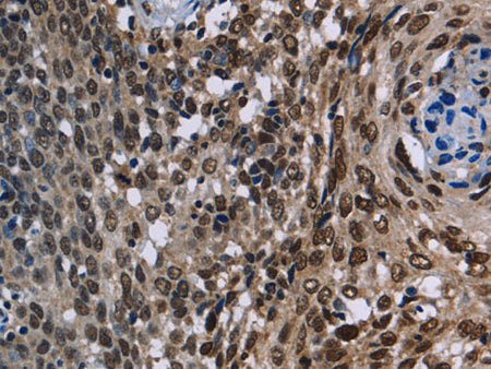 KDM3B Polyclonal Antibody Store at -20°C