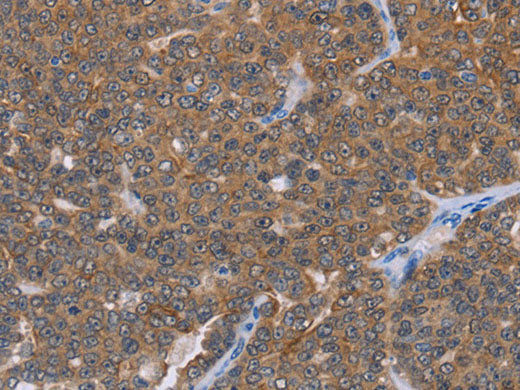 FABP6 Polyclonal Antibody Store at -20°C