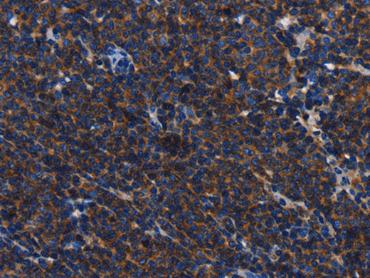 CD45 Polyclonal Antibody Store at -20°C