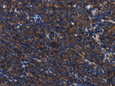 CD45 Polyclonal Antibody Store at -20°C