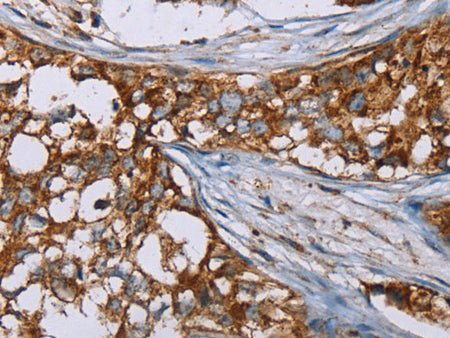 BMP6 Polyclonal Antibody Store at -20°C