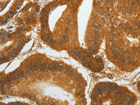 RETNLB Polyclonal Antibody Reactivity Human