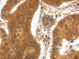 SPDEF Polyclonal Antibody