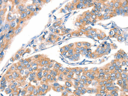 CD297 Polyclonal Antibody Store at -20°C