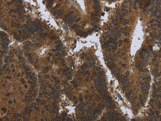 PIP Polyclonal Antibody Store at -20°C