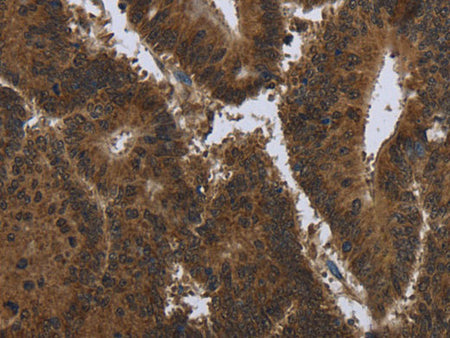 PIP Polyclonal Antibody Store at -20°C