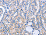 B3GAT1 Polyclonal Antibody Store at -20°C