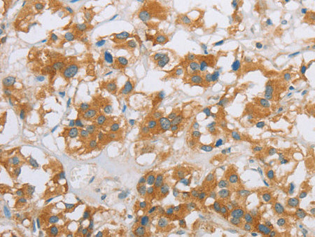 CYP2E1 Polyclonal Antibody Store at -20°C