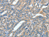 ANGPT1 Polyclonal Antibody Store at -20°C