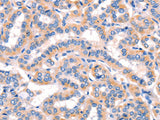 AMY2A Polyclonal Antibody Store at -20°C