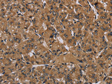 HIF1 alpha Polyclonal Antibody