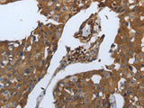 SLC34A2 Polyclonal Antibody Store at -20°C